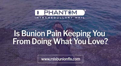 Bunion removal in the Minnehaha County, SD: Sioux Falls (Harrisburg, Tea, Brandon, Renner, Ellis, Benclare, Buffalo Ridge, Rowena, Crooks, Corson) areas