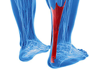 Achilles Tendonitis Treatment in the Brookings, SD 57006 and Sioux Falls, SD 57106 area