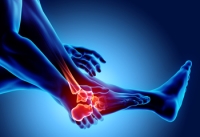 Can Relief Be Found From Rheumatoid Arthritis?