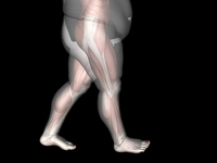 Obesity May Lead To Pronation